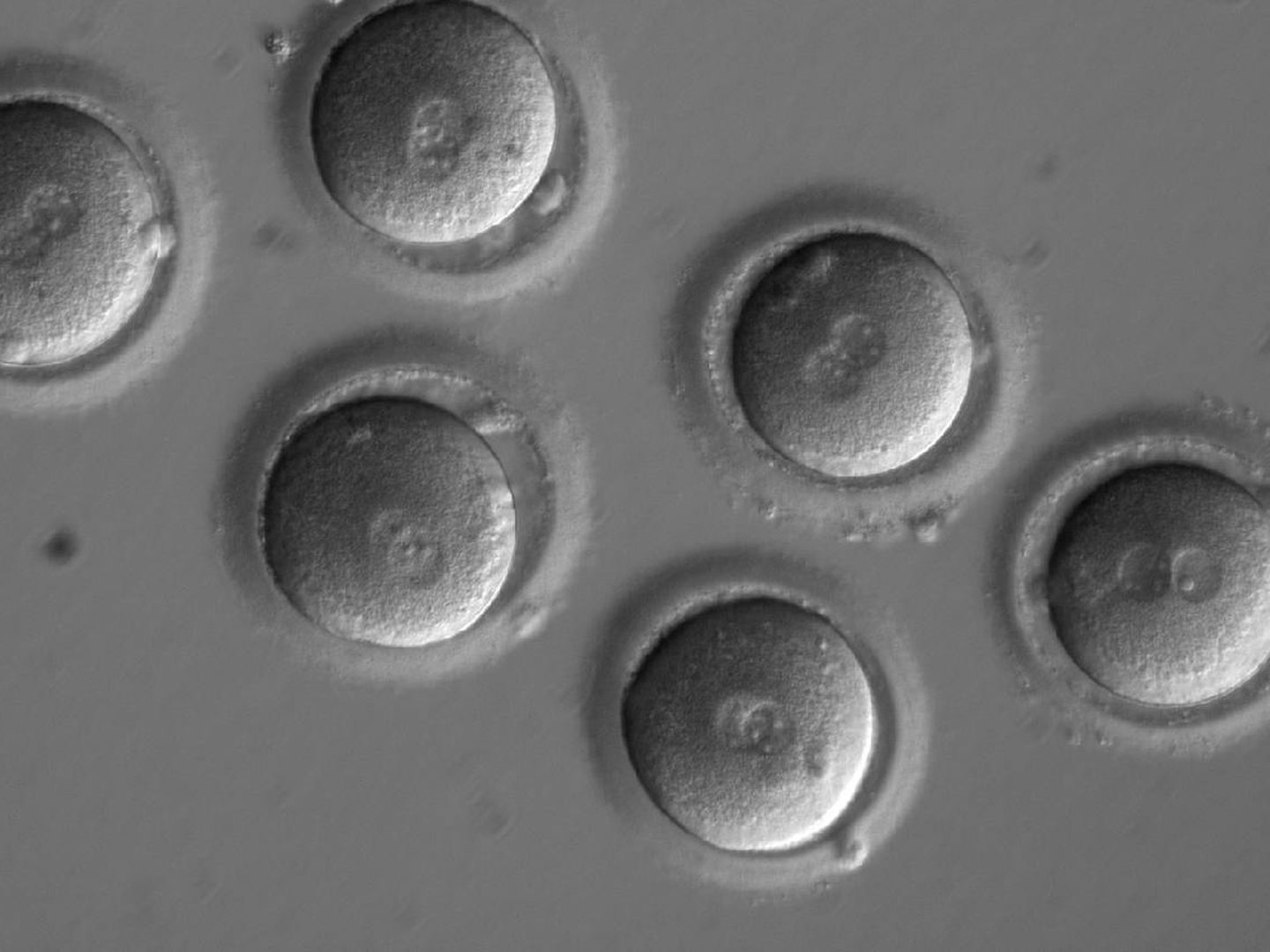 Los embriones ya fertilizados in vitro y tratados con un gen (OHSU)