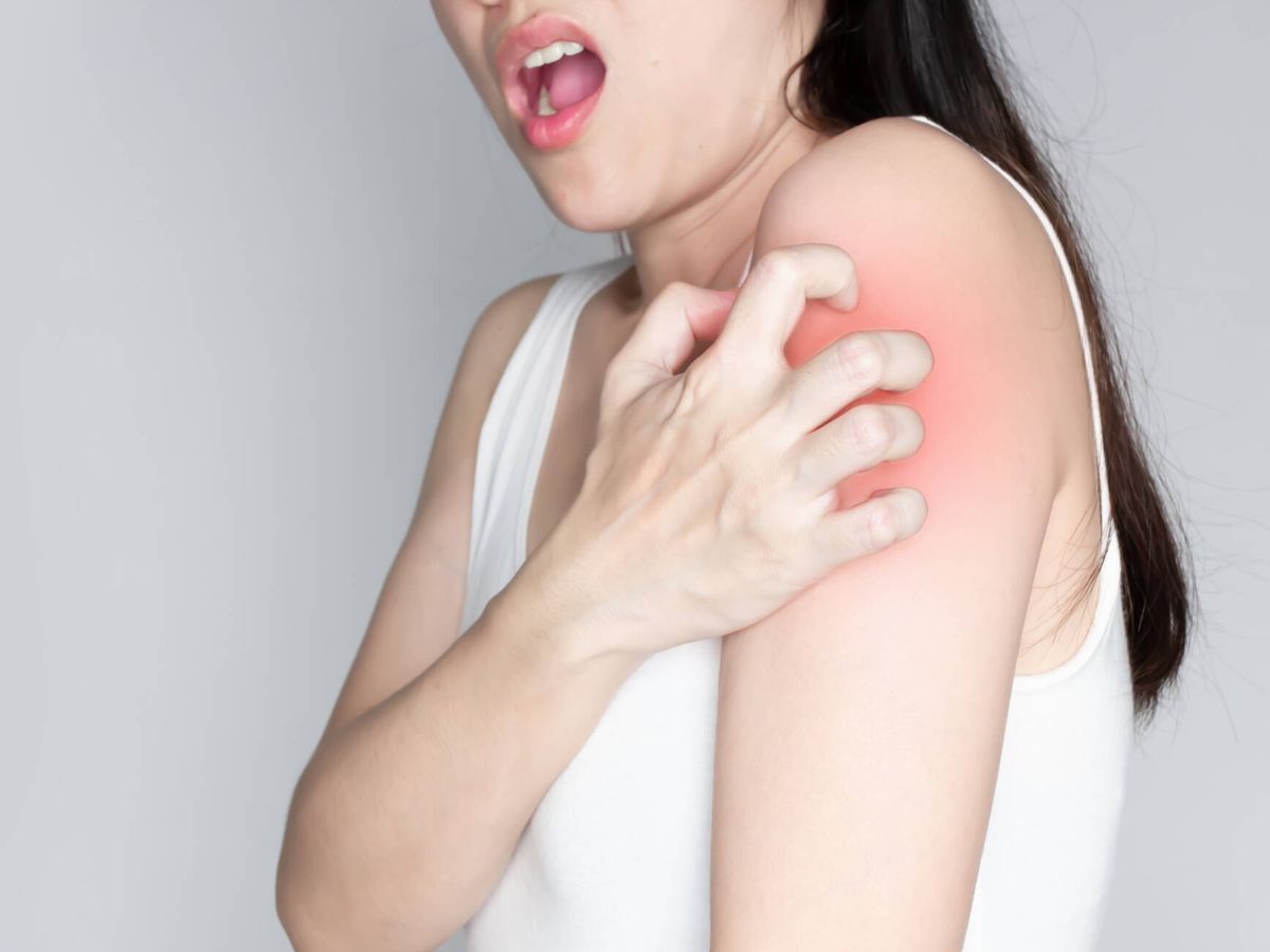 Foto: El picor intenso es el principal síntoma de la sarna. (iStock)