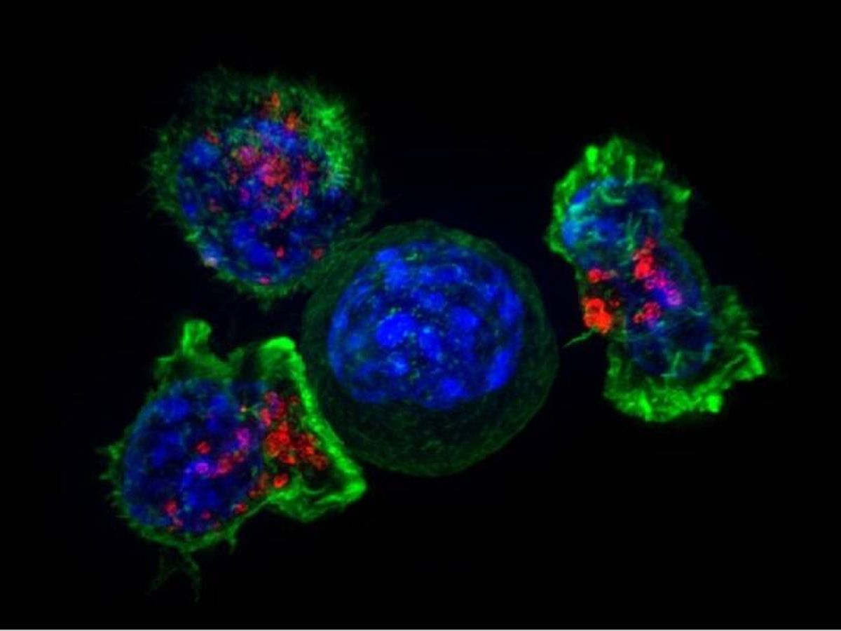 Foto: Células CAR-T (rojo y verde) rodeando células cancerosas (azul). (NIH)