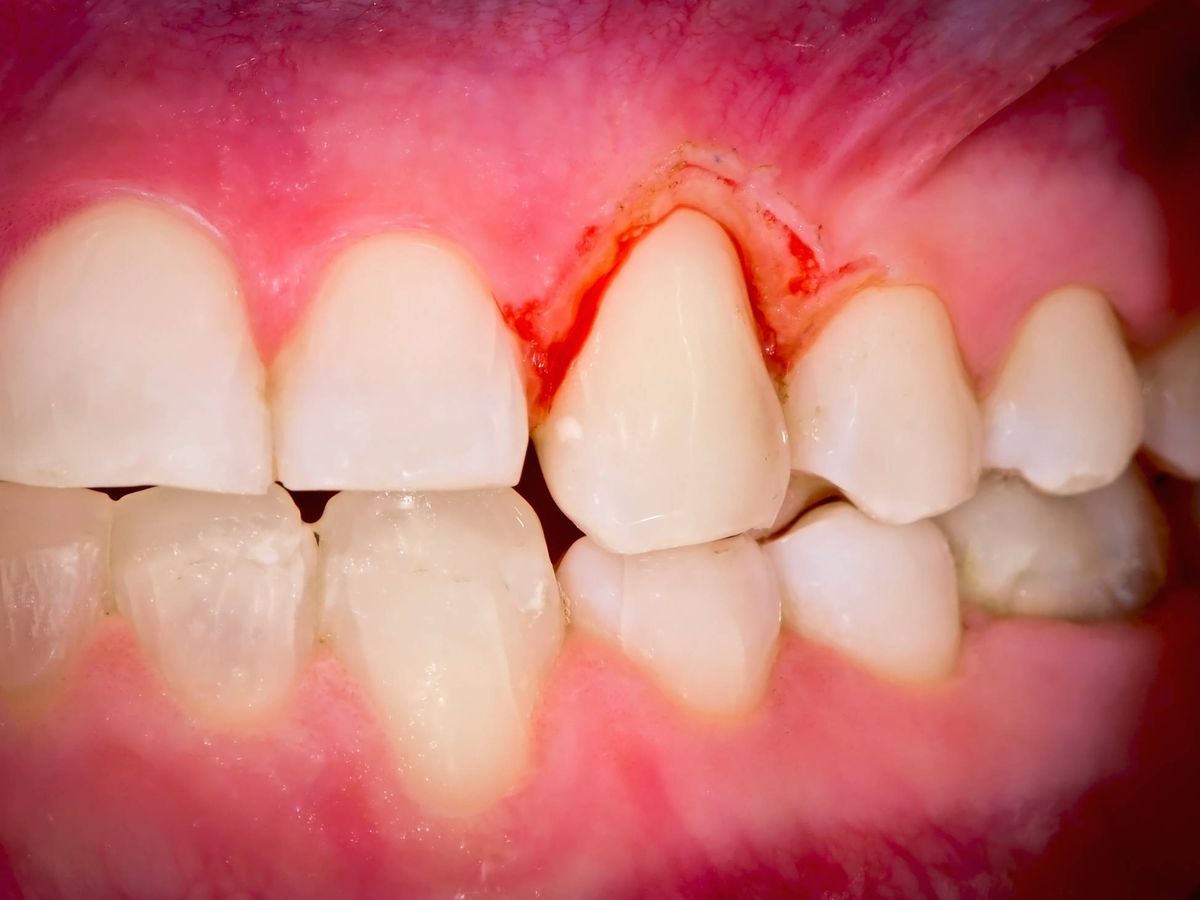 Foto: ¡Cuida tus dientes! (iStock)