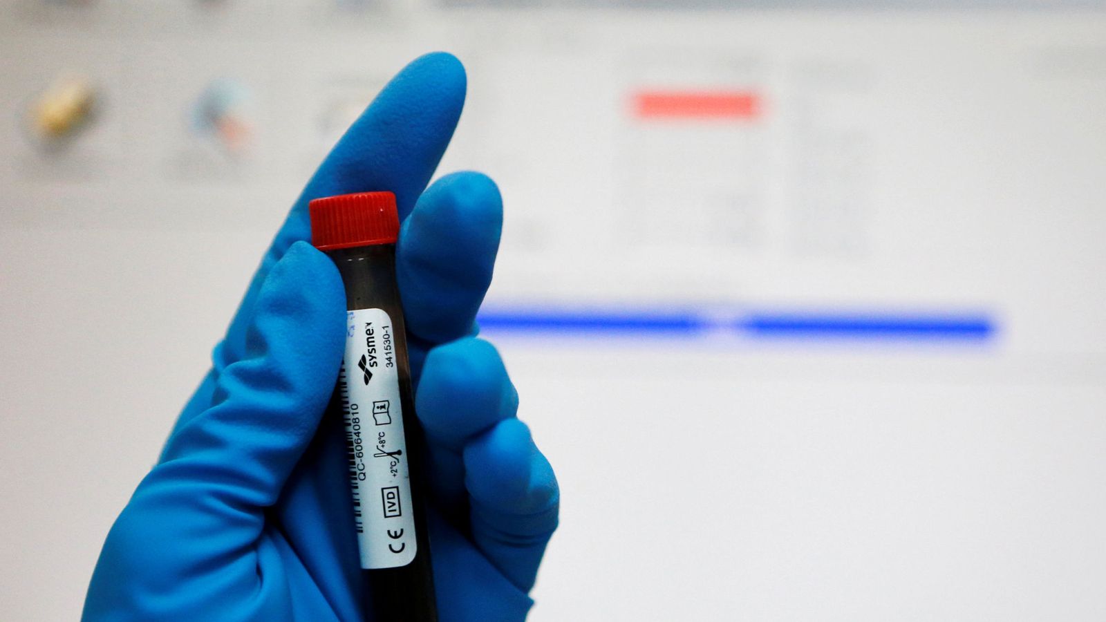 Foto: Un tubo con una muestra de sangre en un laboratorio ruso | Foto: Reuters