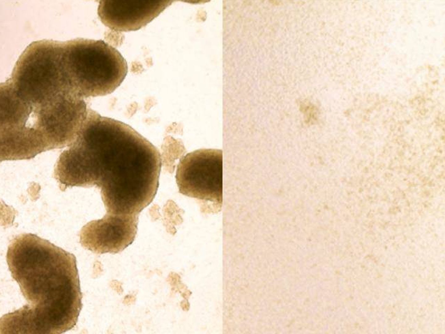 A la izquierda, células madre de glioblastoma; a la derecha, el mismo tejido tras la intervención del Zika. (Zhe Zhu)