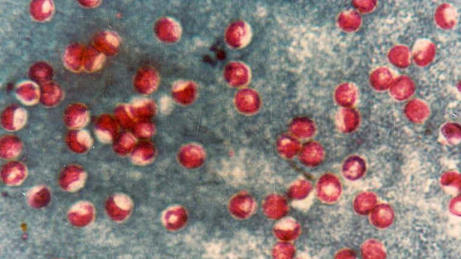Foto: Imagen al microscopio del parásito Cryptosporidium (Alae-eddine GATI)