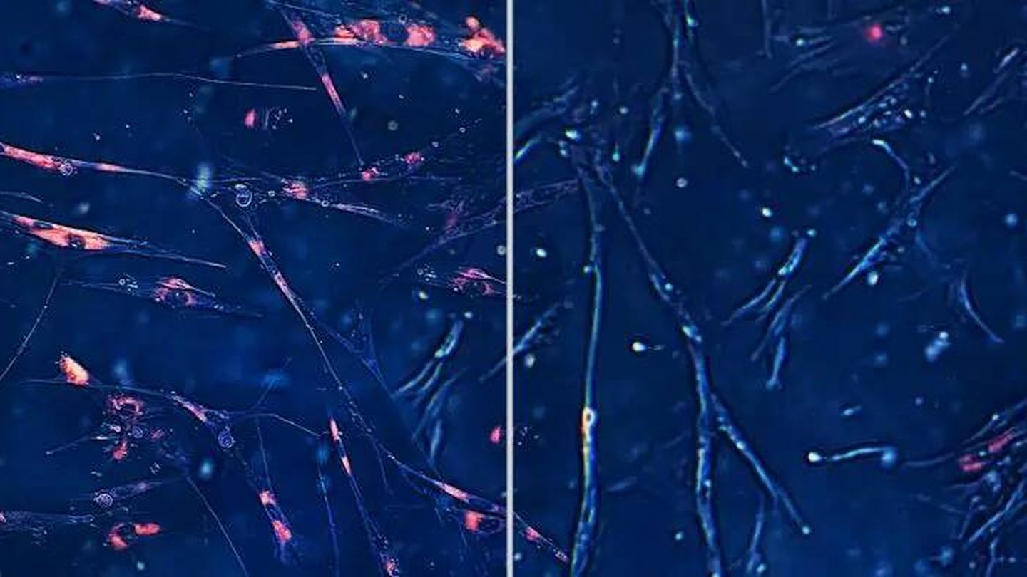 Los senolíticos son una clase emergente de compuestos farmacológicos en investigación que eliminan selectivamente las células senescentes asociadas al envejecimiento (izquierda, con tinción roja) sin afectar a otras células (derecha). (Integrated Biosciences)