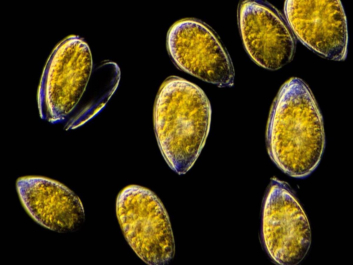 Foto: Imagen microscópica de células de la microalga 'Ostreopsis cf. ovata'. (Rubén Duro, Science Into Images)