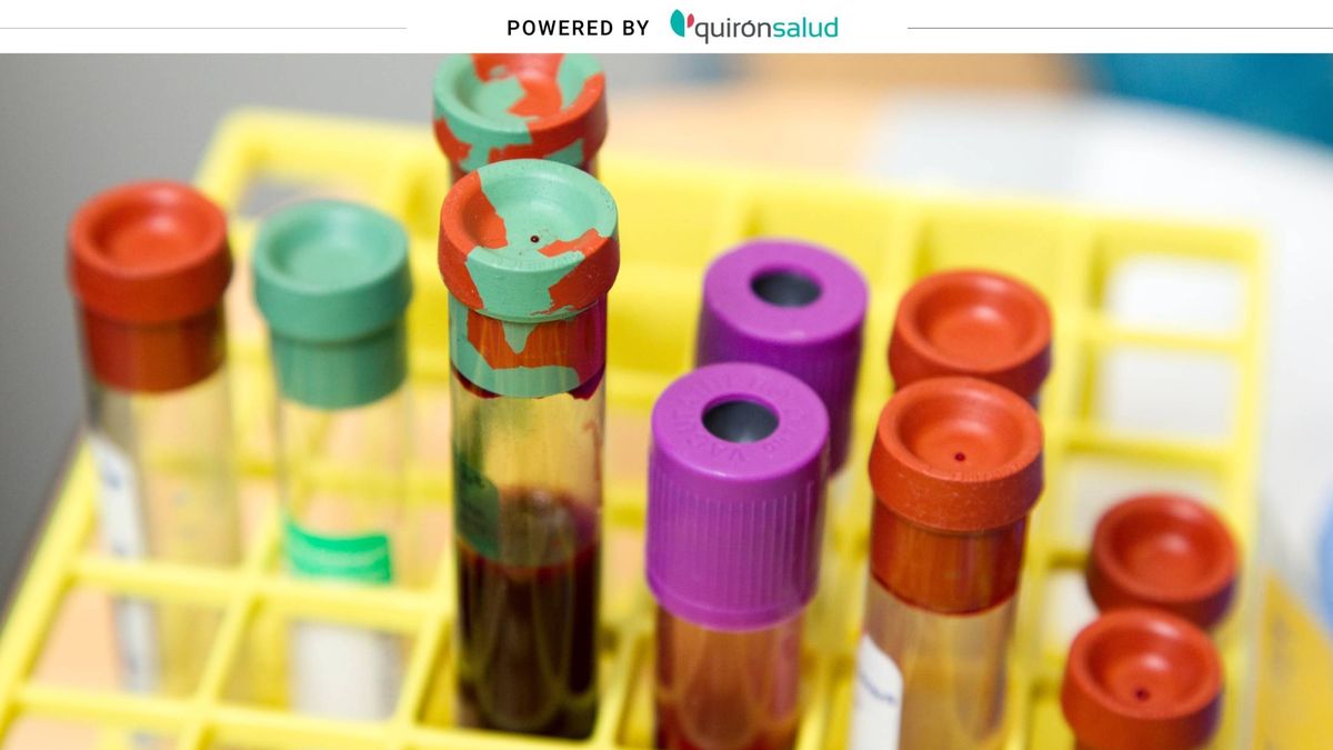 PCR, prueba serológica y test rápido: diferencias y fiabilidad de cada una