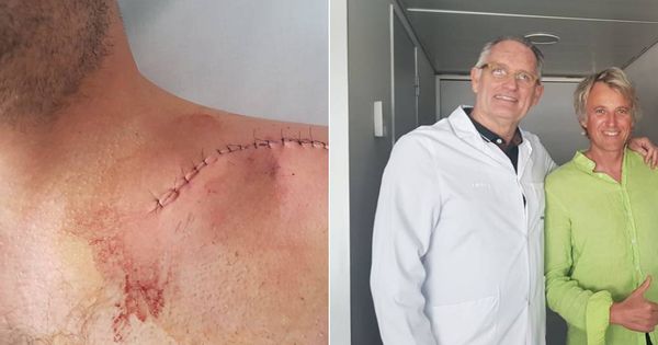 Foto: Jesús Calleja con el doctor Mir y la cicatriz de la operación. (foto jesus calleja)