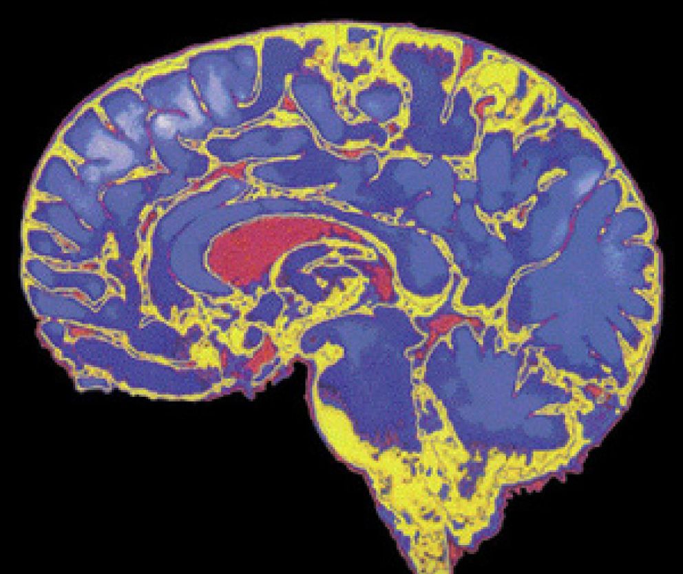 Foto: El cerebro humano se desarrolla hasta el final de la adolescencia