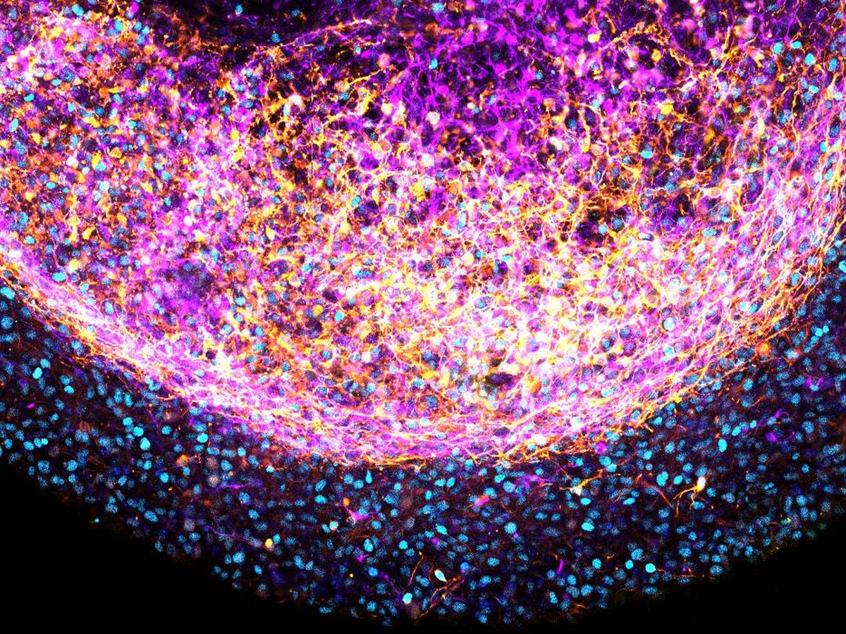 Foto: Detalle del organoide de cerebro. (Artegiani, Hendriks y Clevers)