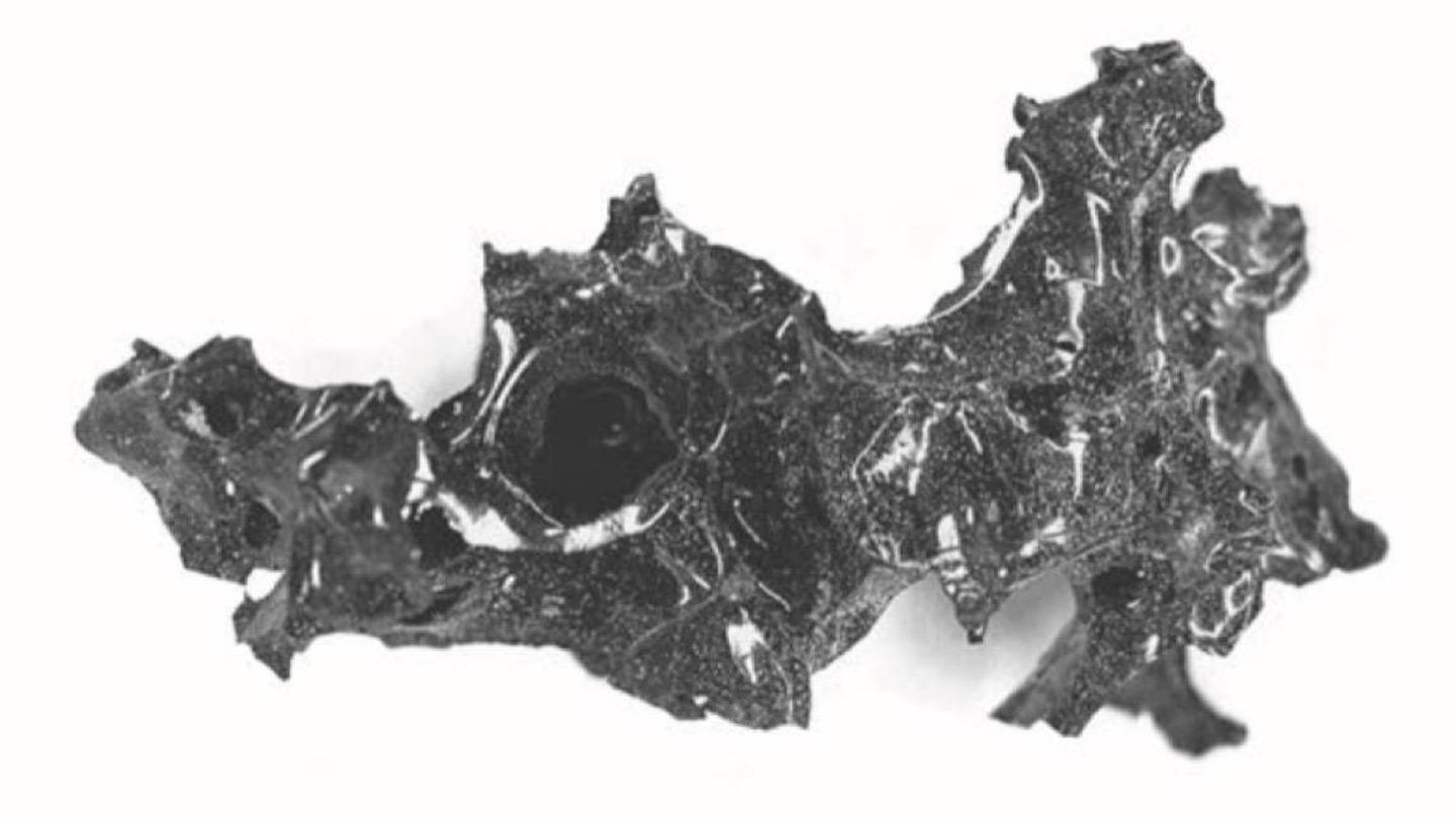 Un fragmento de vidrio encontrado en el cráneo (Foto: The New England Journal of Medicine)
