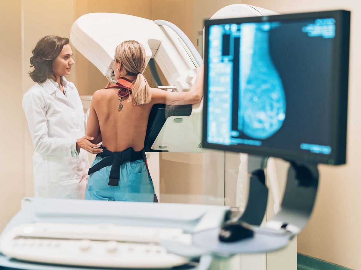 Foto: La mamografía sigue siendo la técnica aconsejada para el screening de mama (Foto: iStock)