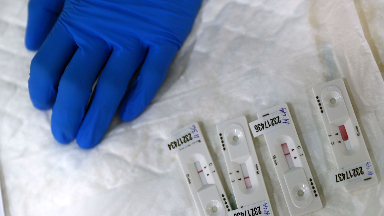 Sanidad registra 23.580 contagios nuevos de coronavirus y 173 fallecidos