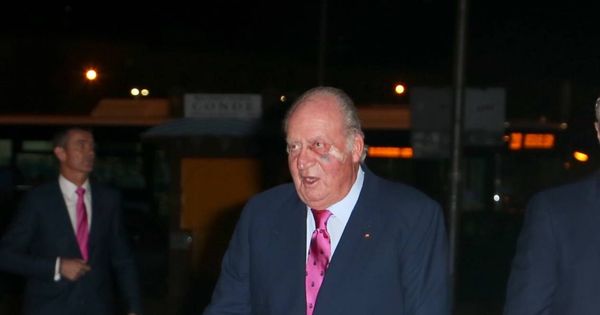 Foto: El rey Juan Carlos, con un fuerte golpe en el rostro. (Vanitatis)