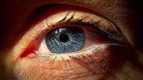 Agujas en los ojos y destellos nocturnos: el precio de la cirugía para librarse de las gafas
