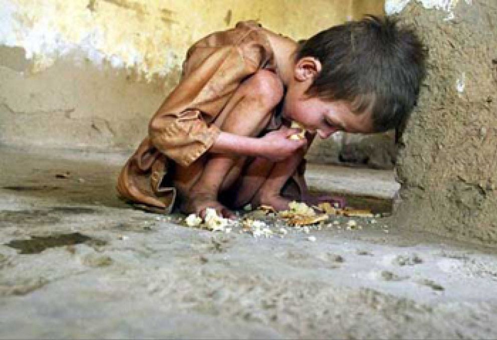 Foto: La desnutrición causa un tercio de las muertes infantiles