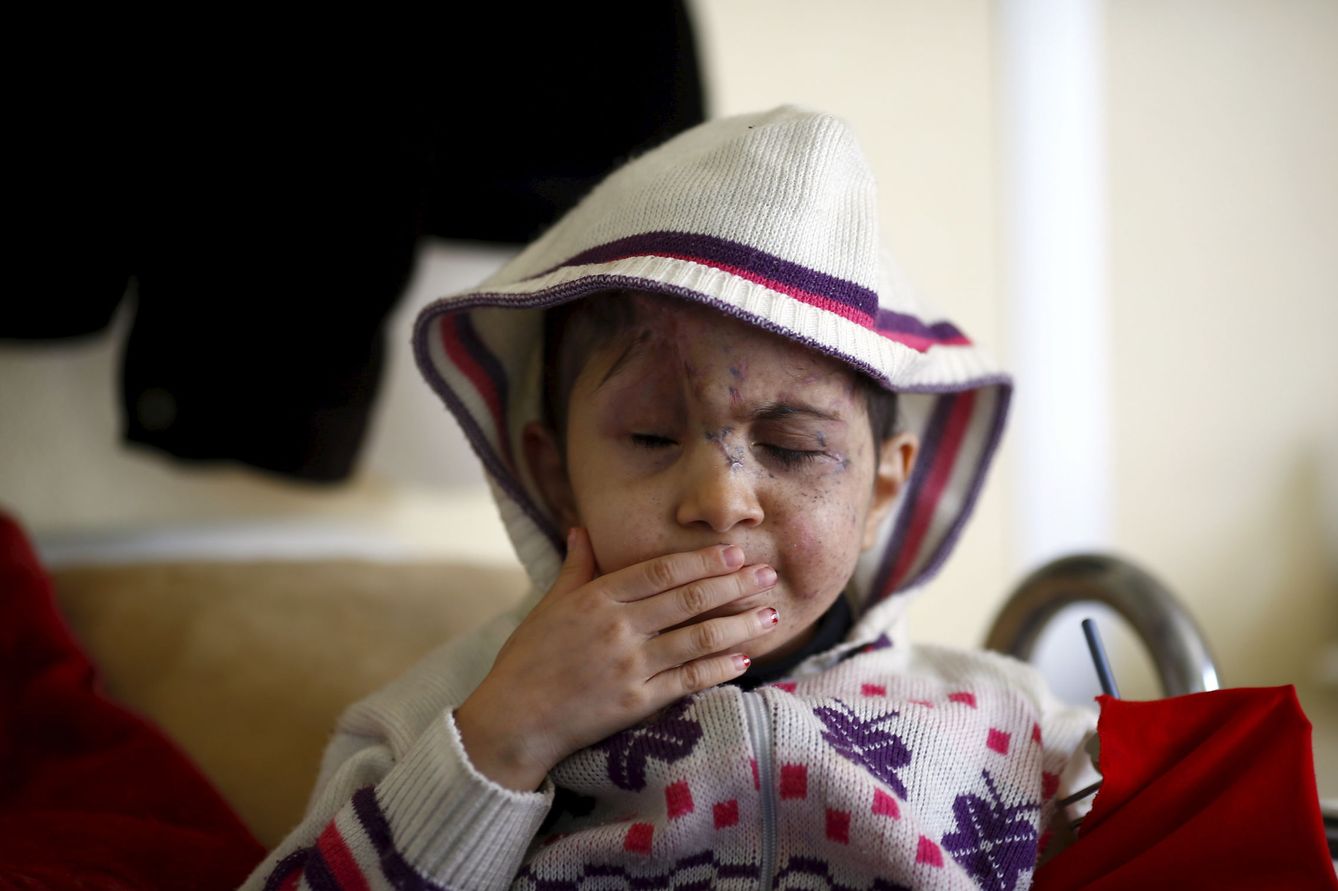 Sheima, de cinco años y que perdió sus ojos por metralla, se recupera en una clínica de Kilis, en la frontera con Turquía. (Reuters) 