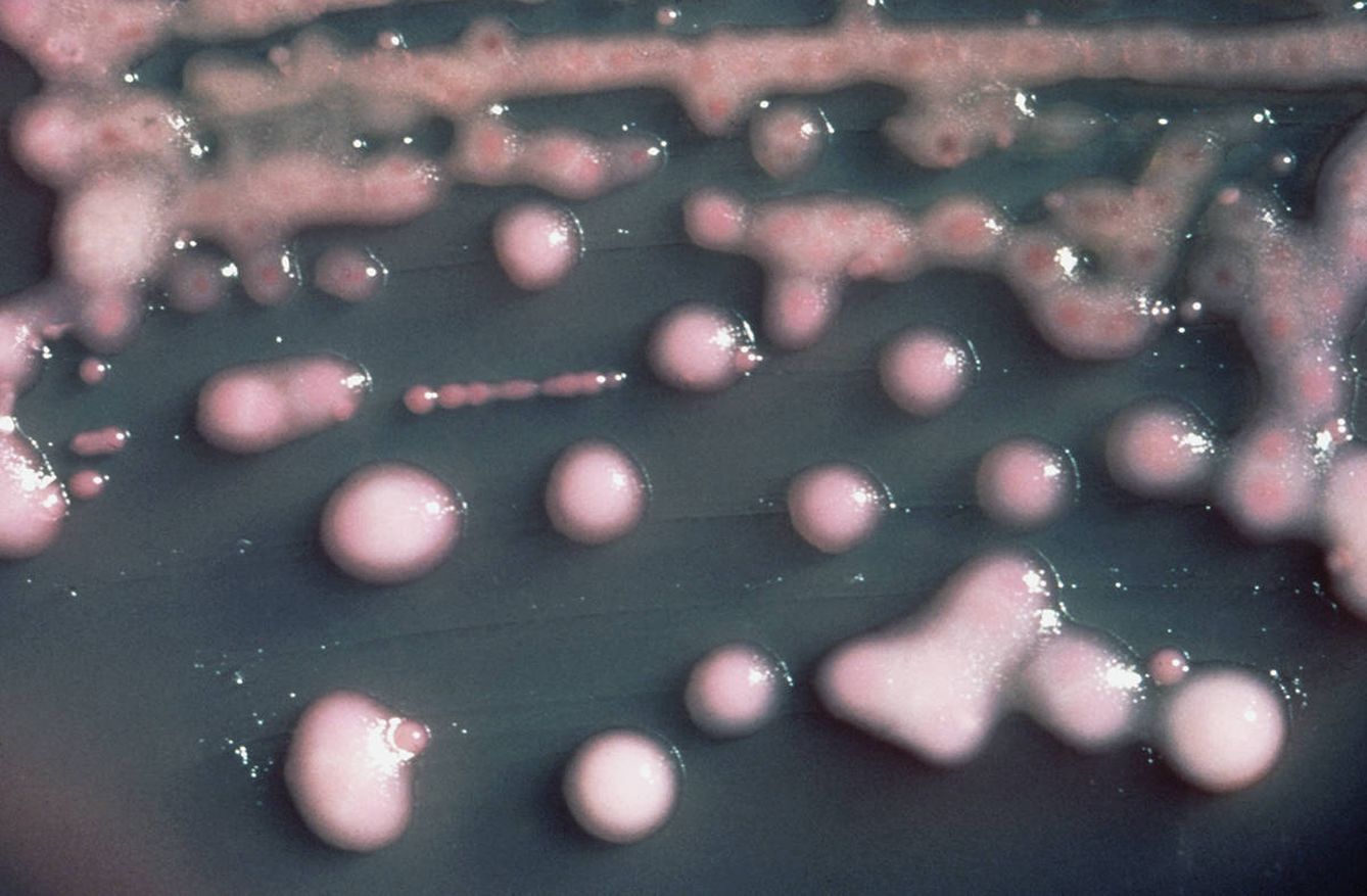 Cultivo de 'Klebsiella pneumoniae', la bacteria que causó la infección de la mujer de Nevada. (Foto: CDC)