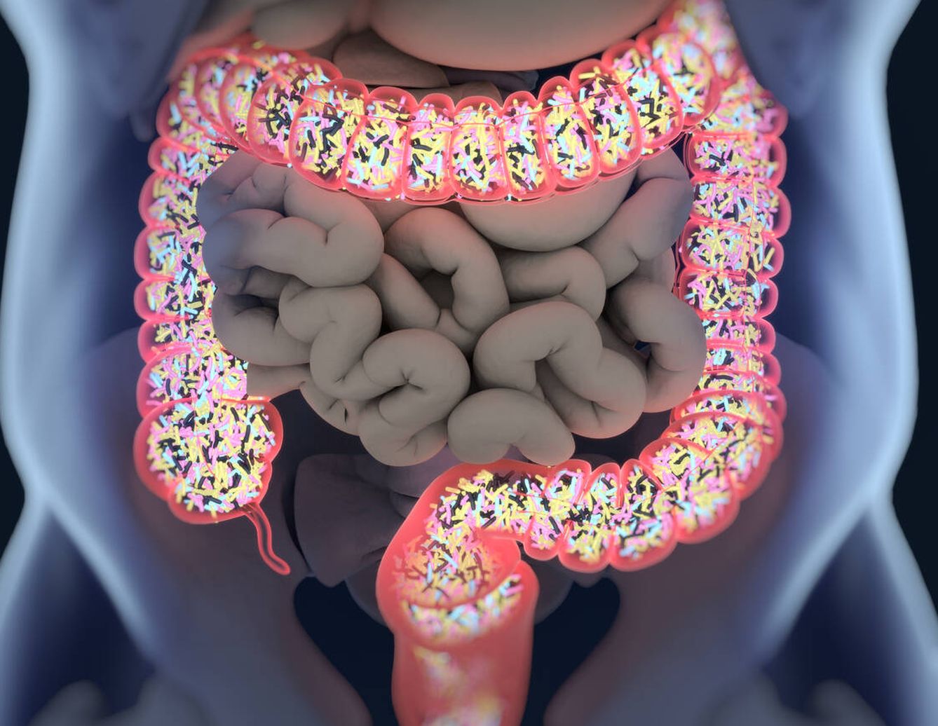 Los edulcorantes pueden causar daños en el epitelio intestinal (Foto:iStock)