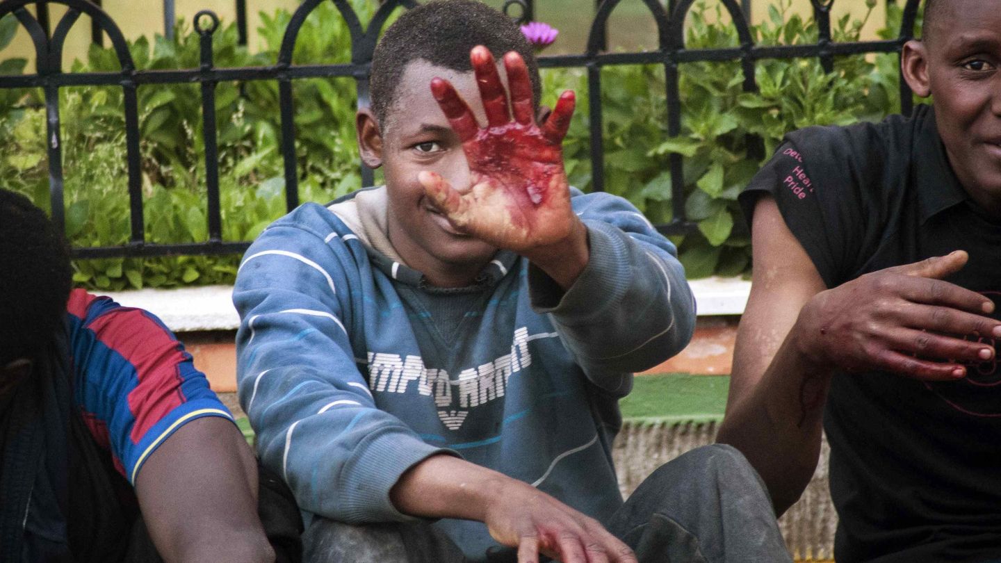 Un inmigrante muestra su mano tras el salto de la valla. (Reuters)
