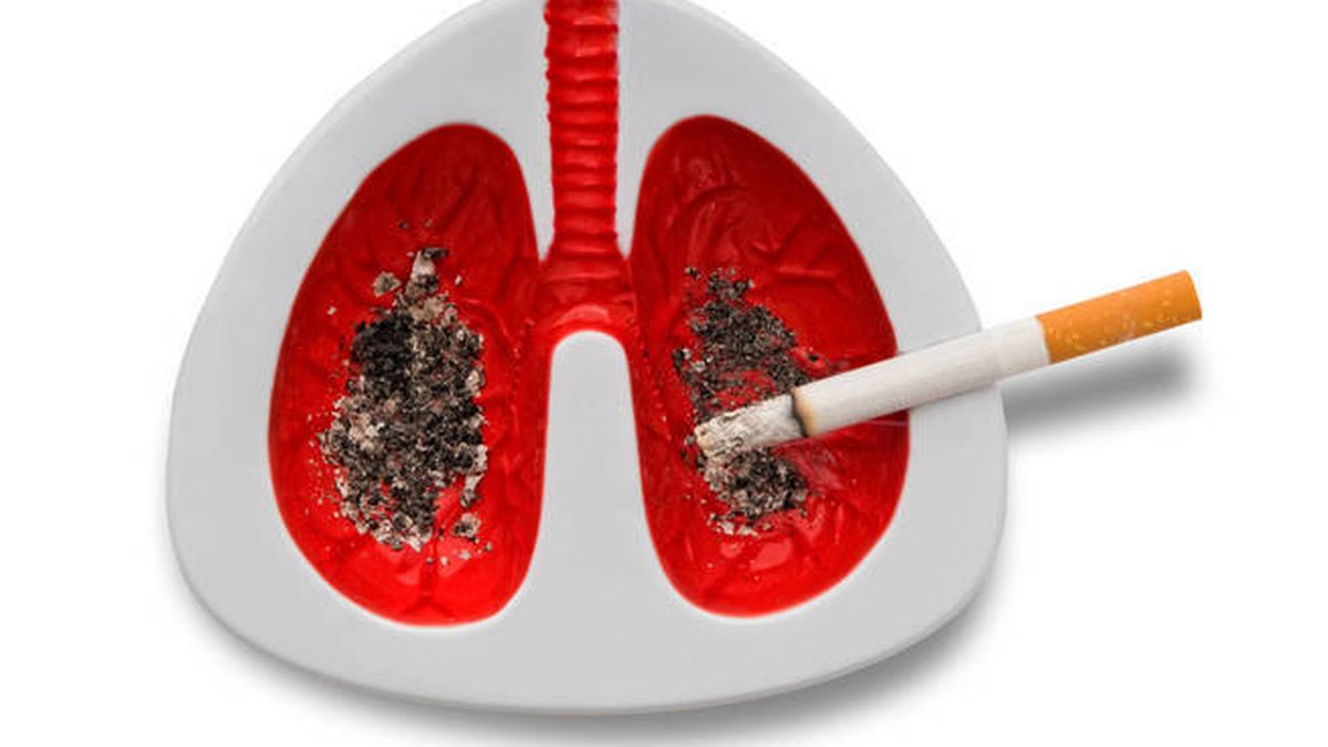 El posbiótico para el cáncer de pulmón que se ensaya en España 