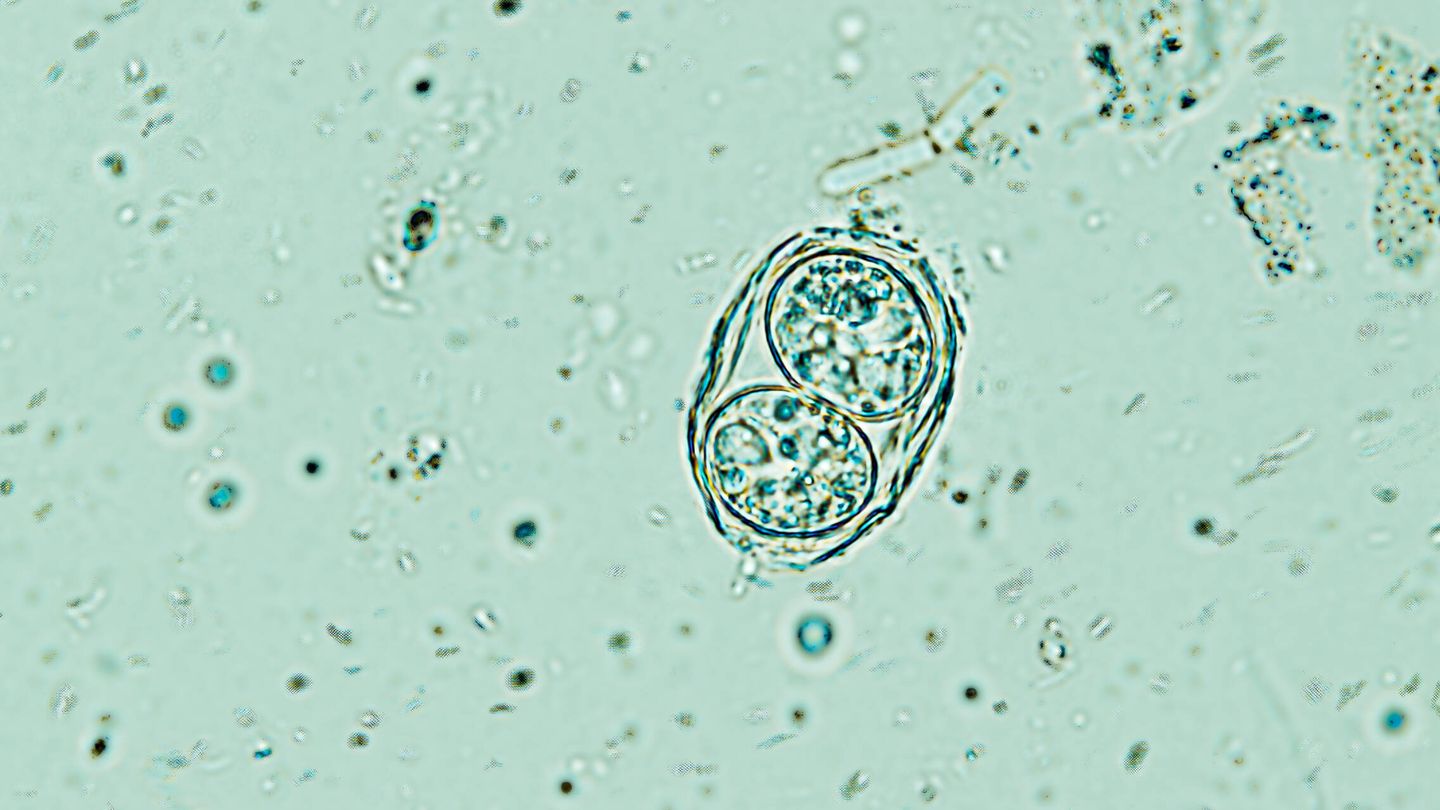 Toxoplasma bajo el microscopio. (Cedida)