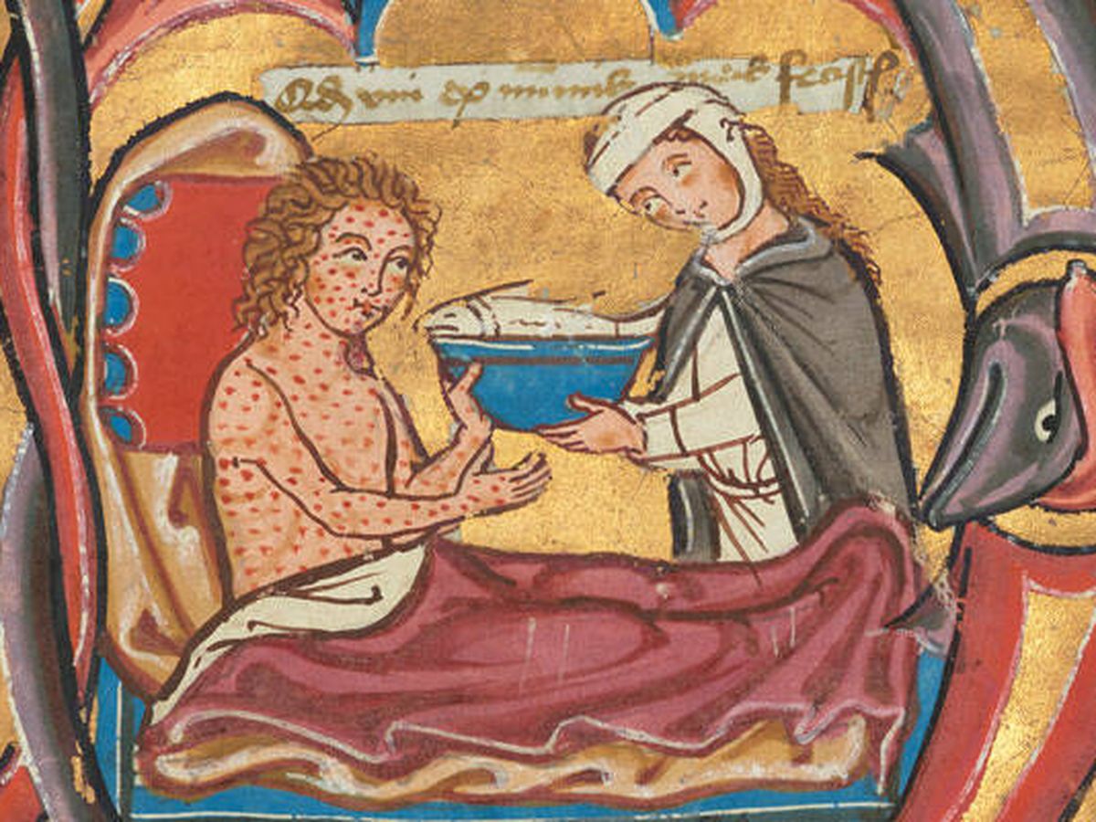 Permeabilidad monitor Barricada Los menús de los hospitales medievales: la dieta de los enfermos no fue lo  que es ahora
